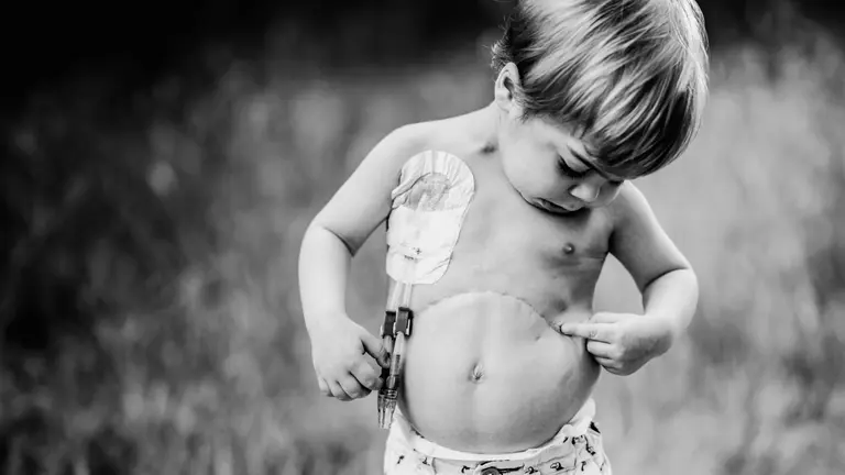 'Una vida para Mateo' de Inma R&iacute;os Escamilla gana el concurso fotogr&aacute;fico de Cinfa. CINFA