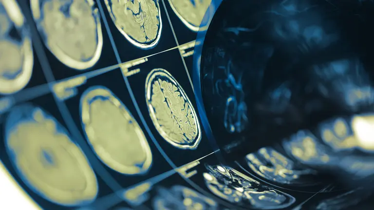 Pruebas en el cerebro humano. Shutterstock - sfam_photo