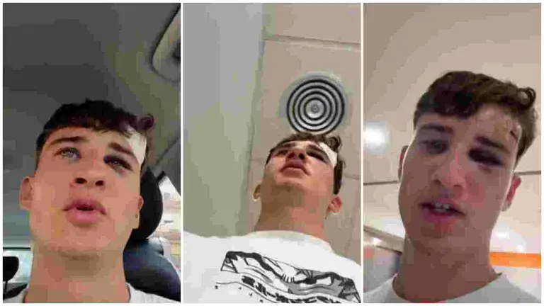 El tiktoker Erik Sánchez en su visita al médico, ya en Barcelona, tras ser pisado en la cabeza por un toro en el encierro de San Fermín. TIK TOK