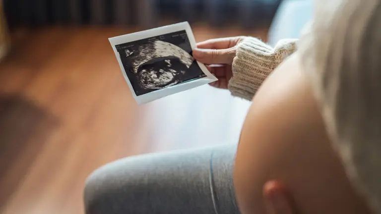 Mujer embarazada que mira su informe de ultrasonido. Shutterstock - oatawa