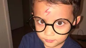 Una madre convierte la cicatriz de su hijo en el rayo de Harry Potter para animarlo a salir de casa