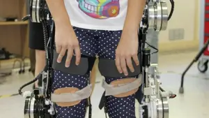 Destinados 10,4 millones a la atención de personas con parálisis cerebral o pluridiscapacidad en Navarra