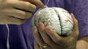 El estrés en el trabajo dobla el riesgo de sufrir un ictus: ADACEN amplía sus servicios y enseña a las empresas cómo combatirlo