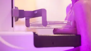 Una prueba que salva vidas: las mamografías consiguen reducir un 35% las muertes por cáncer de mama