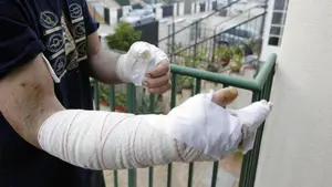 La policía mata a tiros a un perro que no dejaba de morder a su dueño: "Tenía dos disparos encima y seguía"