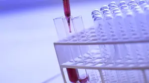 El futuro de la medicina: trabajan en análisis de sangre que podrían predecir la esperanza de vida de cada persona