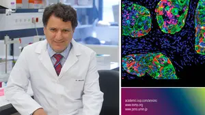 Nuevo avance en Navarra para tratar el cáncer: descubren cómo predecir los pacientes que responderán satisfactoriamente