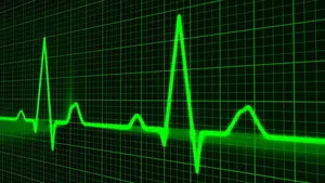 Desarrollan un nuevo modelo matemático en Navarra que podría predecir fallos cardiacos como las arritmias