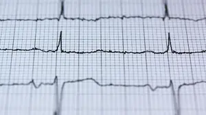 Una nueva herramienta en Navarra permite anticiparse al deterioro de pacientes con problemas cardiacos