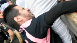 El dolor, en su cara: toda la secuencia del golpe en el cuello al joven de Telefónica que casi termina en tragedia