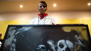 Padilla, operado por el agravamiento de sus heridas en la cara, en duda para venir a Sanfermines 