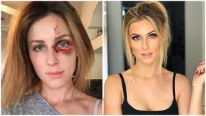 Un campeón de motocross da una brutal paliza a su novia por subir una foto a Instagram