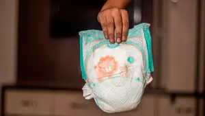 Se propaga fácil: expertos aconsejan sobre cómo tratar a los niños ante el último gran brote que afecta a Navarra