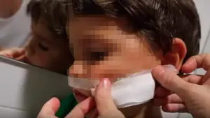 El mayor susto de Verdeliss: herido con quemaduras uno de sus hijos al meter la cabeza en un horno encendido