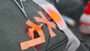 Una pelea 'salvaje' por una cuestión de tráfico acaba con dos conductores en el hospital de Tudela