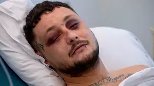 Buscan al joven que agredió a su novia y a otro chico que trató de evitar la paliza a la mujer