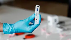 Un experto de la Universidad de Navarra afirma que el estudio de seroprevalencia "dará pistas útiles"