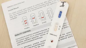 Las farmacias piden autorización al Gobierno para realizar los tests y "no especulan" con mascarillas