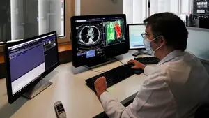 La CUN inicia un estudio para realizar el diagnóstico y evaluar las complicaciones del coronavirus