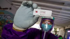 Un grupo de investigadores ha desarrollado un nuevo test que diagnostica el Covid-19 con mayor rapidez