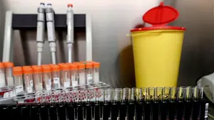 Los 48 nuevos contagios de Covid-19 en Navarra retrotraen la situación epidemiológica hasta finales de julio