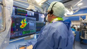 La Clínica Universidad de Navarra, pionera mundial en un nuevo catéter para fibrilación auricular