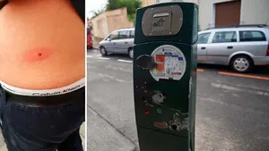 Disparan a un vigilante de la zona azul en la Chantrea: herido por el impacto de un perdigón