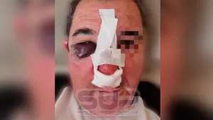 Brutal agresión a un policía nacional de Tudela cuando intentaba aparcar en Zaragoza