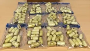 Detenido en un hospital de San Sebasti&aacute;n despu&eacute;s de extraerle del est&oacute;mago dos kilos de coca&iacute;na