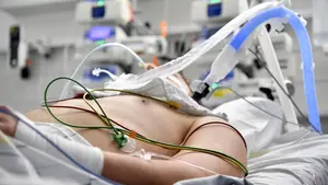 El PSN niega que el jefe de la UCI del Hospital Universitario de Navarra haya dimitido