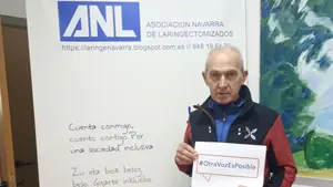 El cáncer que afecta a 200 personas en Navarra y ha incrementado los casos en los últimos años