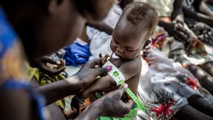 Los recortes en la ayuda global podrían revertir décadas de progreso en salud y desarrollo