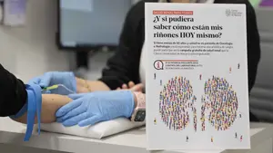 El dato que alerta a los nefr&oacute;logos en Navarra: cuatro de cada diez adultos sanos ya muestran riesgo renal