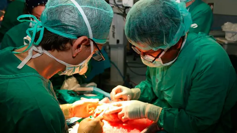 Dos médicos realizan un trasplante.