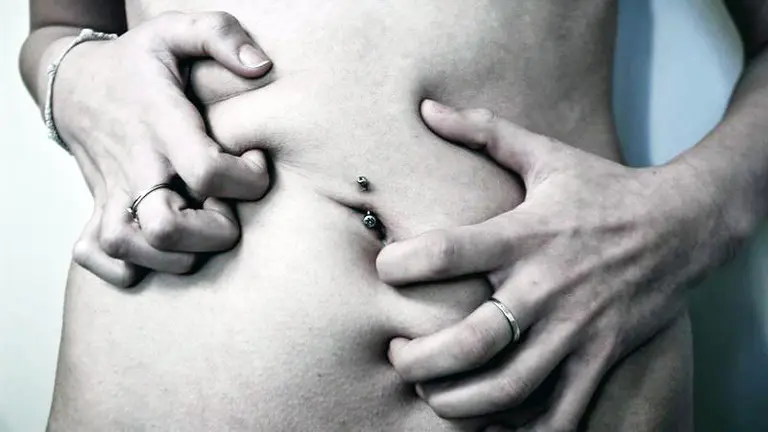 Anorexia y bulimia. EP.