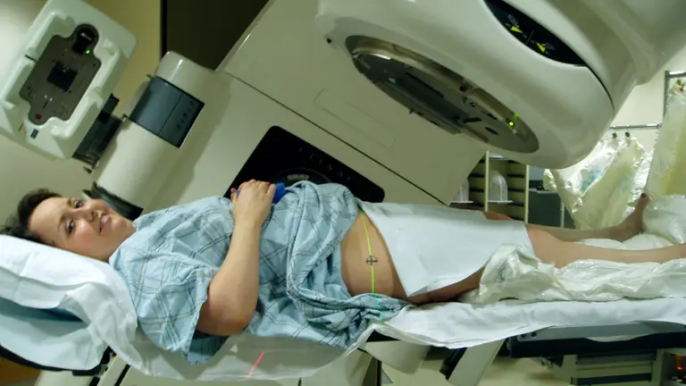 Una paciente se somete a un tratamiento de radioterapia. ARCHIVO