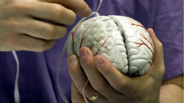 Alerta en Navarra por un aumento de los casos de ictus. EFEMiguel Rajmil