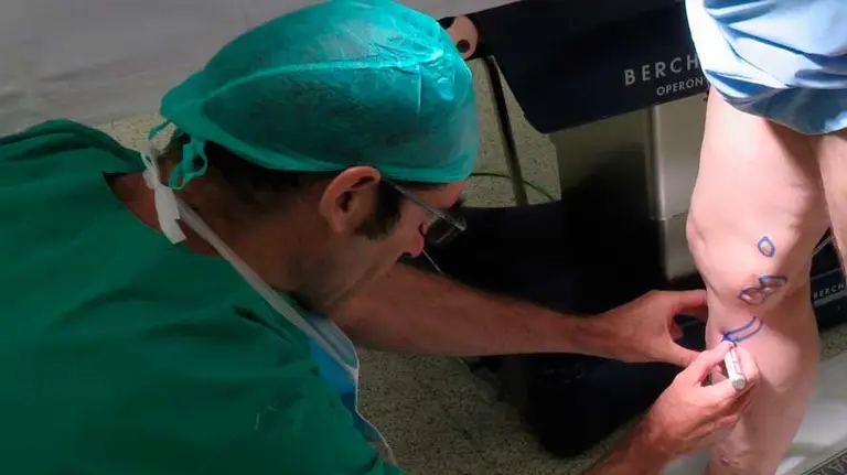 Un paciente se somete al nuevo método para tratar las varices de forma ambulatoria.