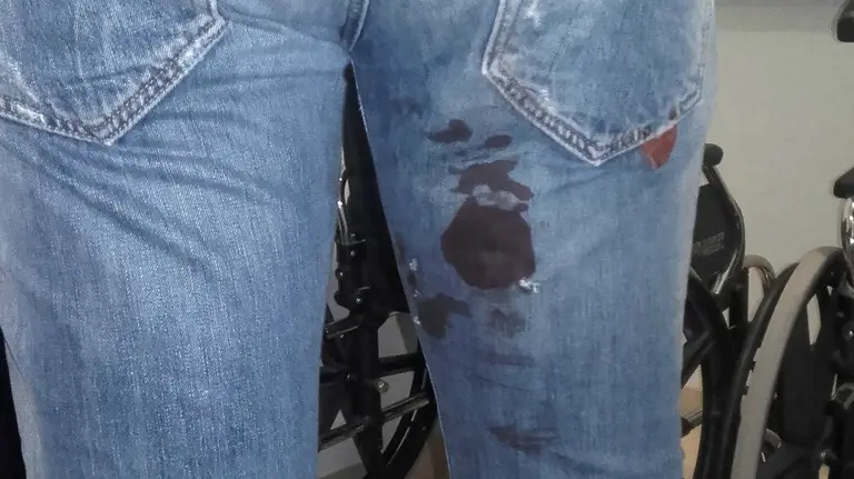 Detenido en Peralta por propinar varias puñaladas en un bar. PFORAL