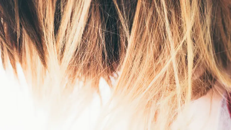 La víctima perdió el 80% de su cuero cabelludo.