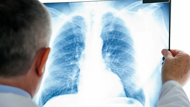 Un médico consulta una radiografía.