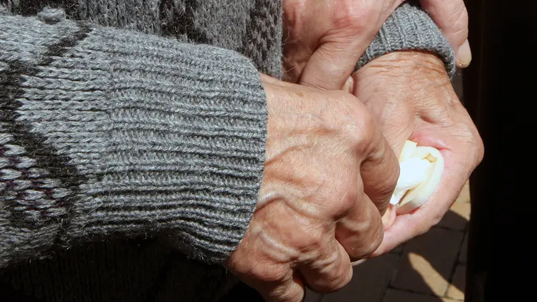 Las manos de una persona de avanzada edad. ARCHIVO