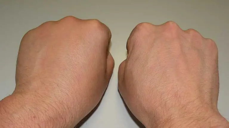 Manos de una persona con los puños cerrados. ARCHIVO