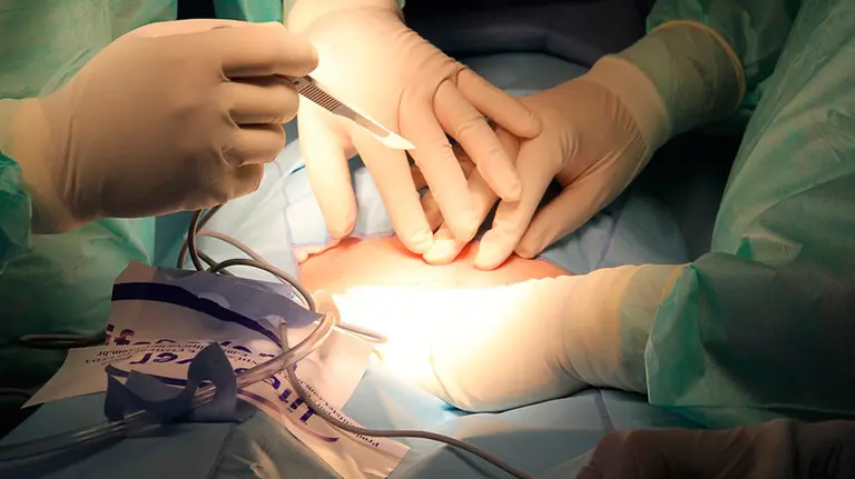 Varios médicos practican cirugía a un paciente