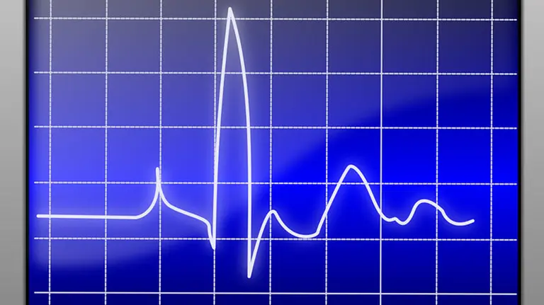 Un contador de pulsaciones