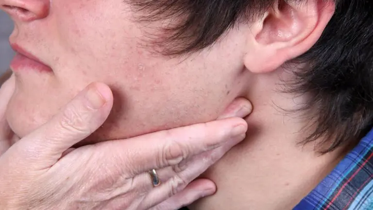 Un médico revisa a un paciente por un posible caso de paperas ARCHIVO