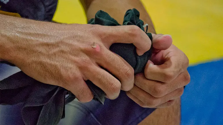 Un hombre con heridas en los nudillos tras propinar un fuerte golpe a otra. ARCHIVO