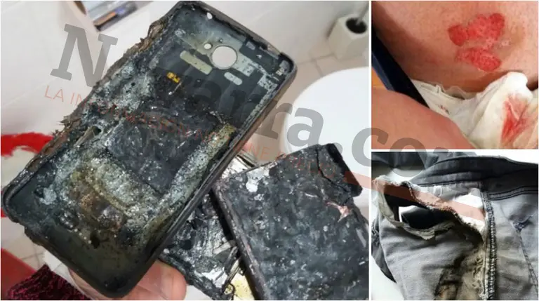 Estado en el que quedó el teléfono del chico de Pamplona de 13 años después de explotar e incendiarse. Arriba a la derecha las heridas en la pierna del joven. Abajo, el pantalón vaquero completamente quemado. 