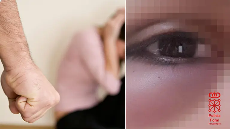 Imagen de una de las lesiones sufridas por una víctima de violencia de género en Navarra junto a una fotografía de un hombre amenazando a una mujer NAVARRACOM