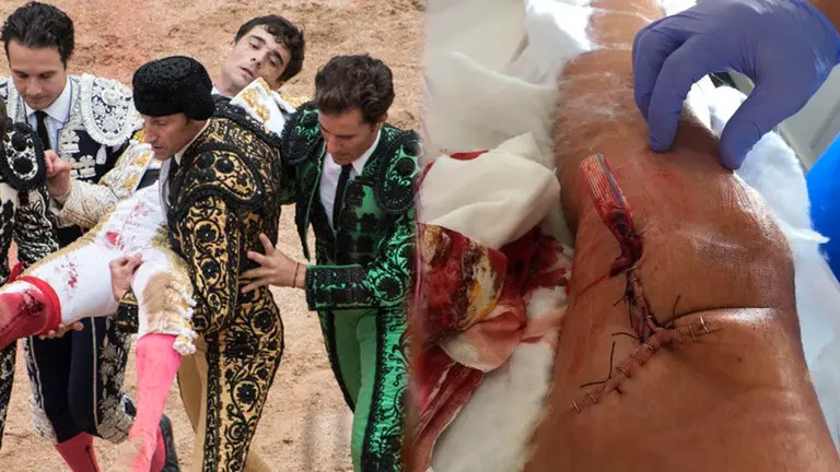 Paco Ureña, corneado en las corridas del sábado, mientras era evacuado de urgencia a la enfermería de la plaza junto a una imagen de la grave herida sufrida en el muslo derecho NAVARRACOM